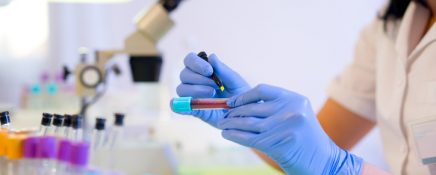 Woman working in a laboratory. He writes with a felt pen. Selective focus